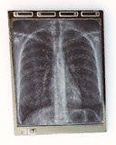 Lenticular X-Ray Light Box